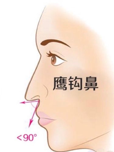 什么是鹰钩鼻 有鹰钩鼻的人命运如何