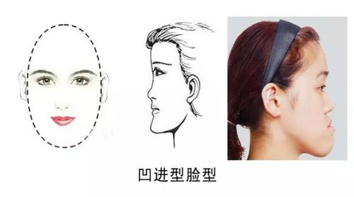 识人术:从下巴看你爱情命运