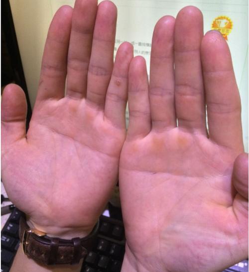 双手断掌的男人短命吗