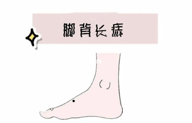 男人脚背痣相图解