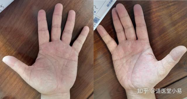 土型手的特征 有土型手的人命运如何