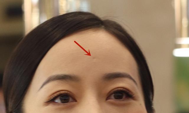 额头有凹陷的小坑