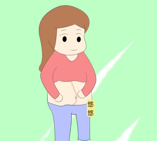 生女孩的妊娠线图片,有图有真相!