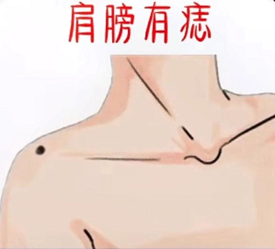 女生左肩膀上有痣代表什么