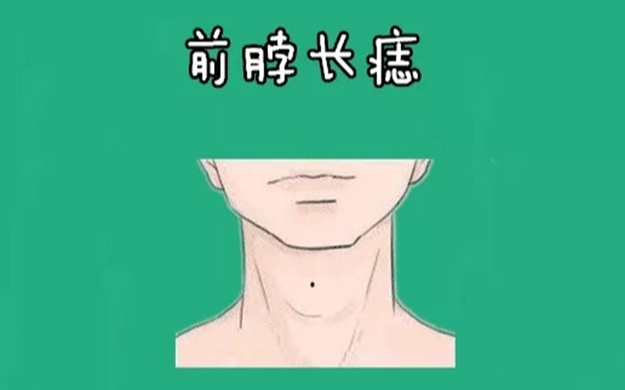 靠山痣有多厉害