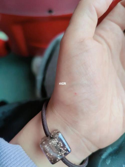 手掌上有朱砂痣代表什么?好不好?