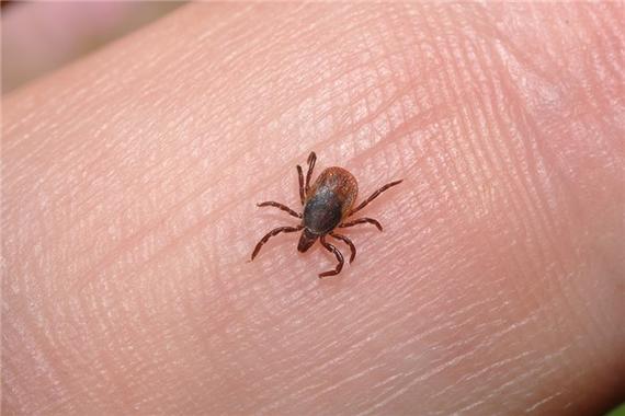 梦见头上梳掉虱子挤死是什么意思