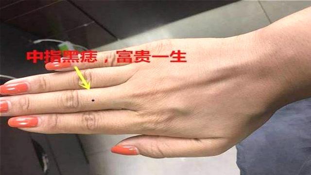 右小指有痣子孙运好