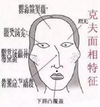一个女同性恋的八字和面相解读