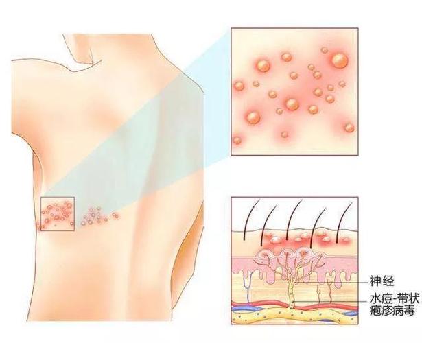 梦见蛇缠腰上 梦见蛇缠腰上是什么意思女人