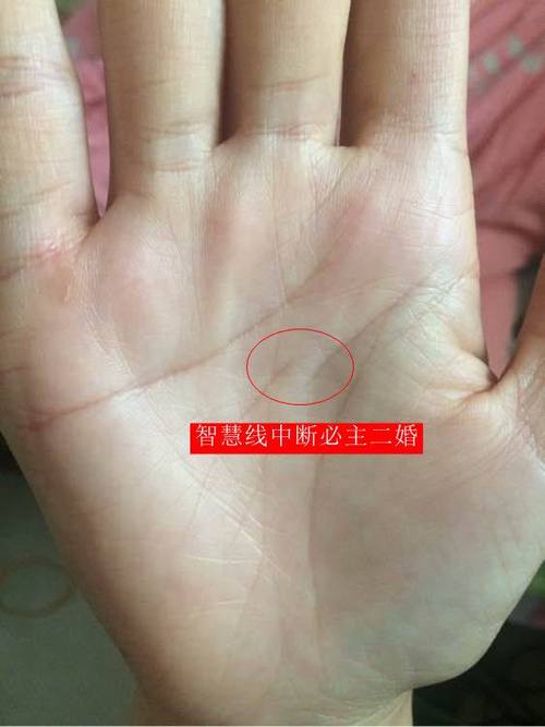 命运线到智慧线没了的说法
