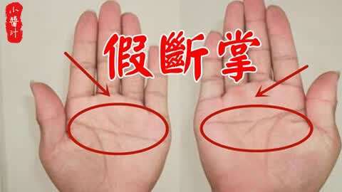 假断掌真的很悲惨吗