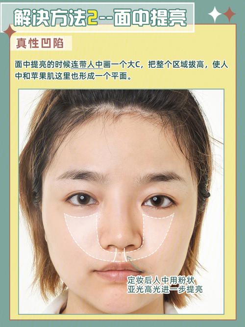 凹陷鼻有哪些说法?