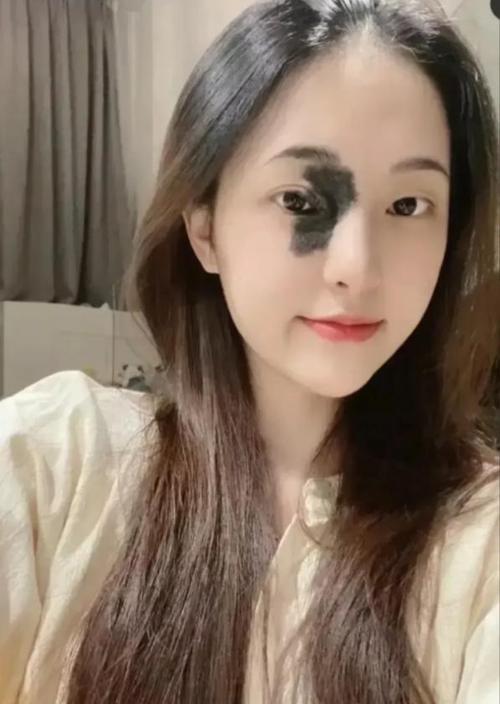 女人脸上有胎记好不好