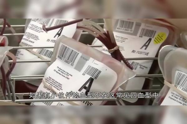 稀有万能血有哪些