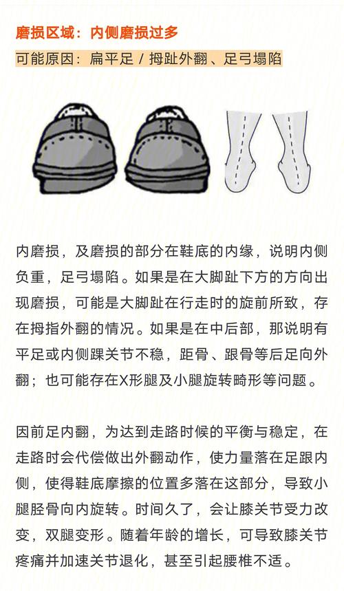 鞋底磨损程度分析性格