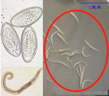 梦见从屁股里爬出虫子,梦见屁屁里爬虫子是活的