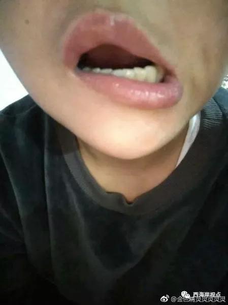 笑起来嘴向左歪的人好招是非吗
