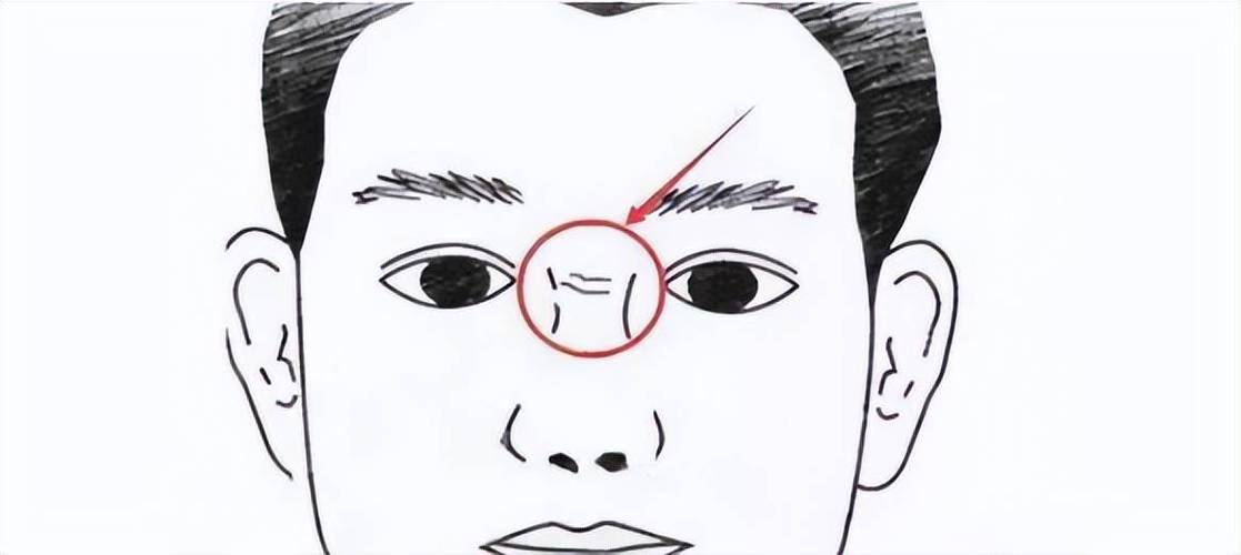 鼻梁上长青筋的女人面相好吗?青筋面相分析!(讲解)