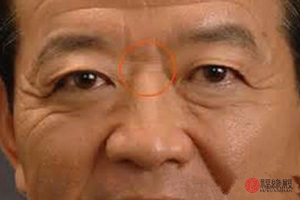 山根是什么,山根断的人