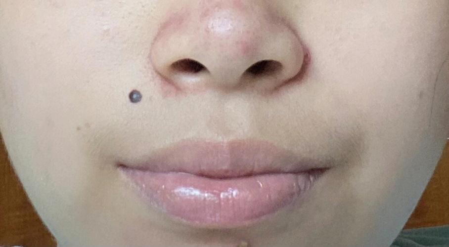 媒婆痣面相 媒婆脸上的痣有何含义