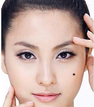 有哪些痣容易造成离婚危机?