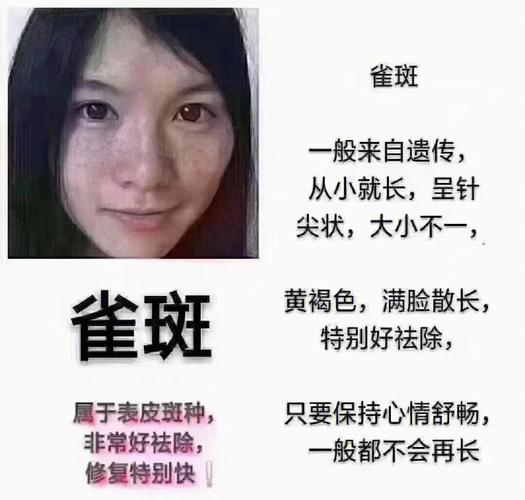 女人满脸雀斑在面相学中有什么意思?好不好?