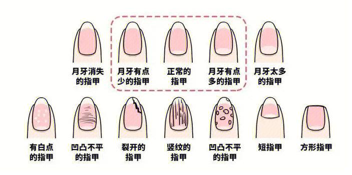 指甲的生长与健康有关系吗