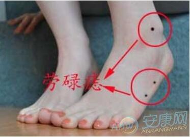 脚上长痣的女人面相图解
