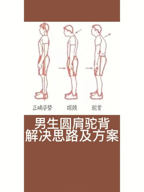 为什么说驼背的男人不能嫁