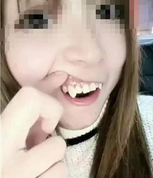 长虎牙的女人会克夫吗