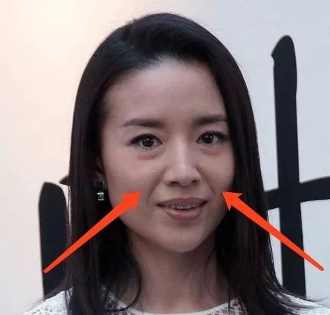 法令纹是什么，法令纹