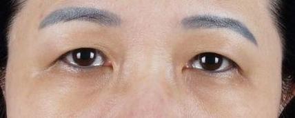 眼角下垂的男人女人