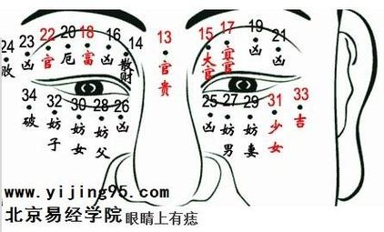 眼睛有善痣代表什么含义解析