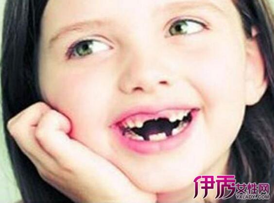 女人梦见牙齿粉碎脱落
