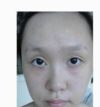 眼窝很深很黑的女人在都比较斤斤计较
