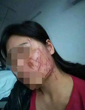 面颊破相意味着什么？