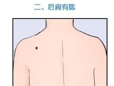 肩上有痣代表什么