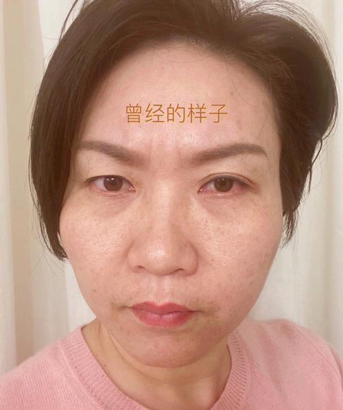 女人川字纹有什么影响