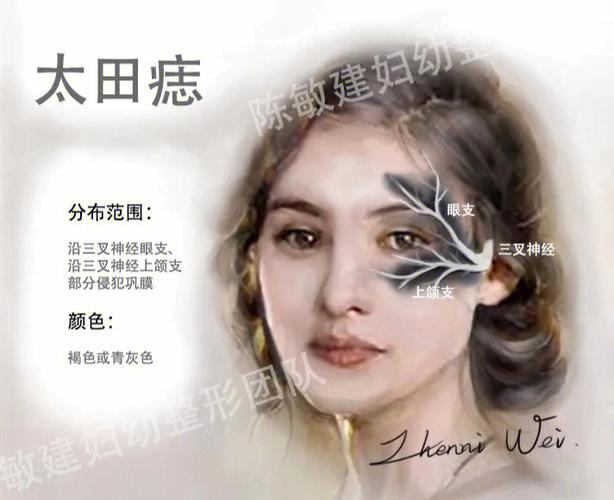 胎记长在脸上好不好,代表什么命运?