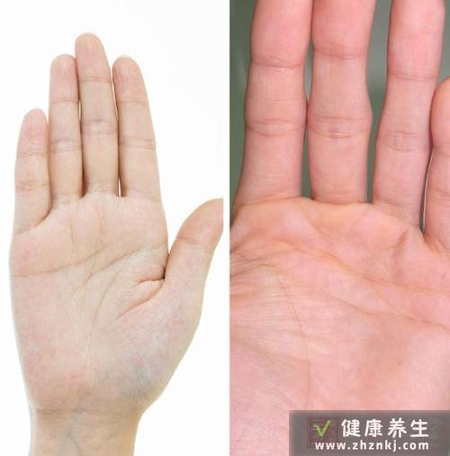 你的健康,手掌颜色偷偷告诉你