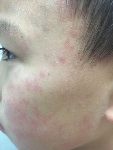 手心脚心同时长了一个痦子面相