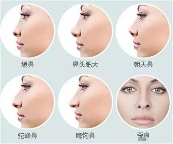 女性鼻削如刀面相好吗?女人鼻削如刀面相