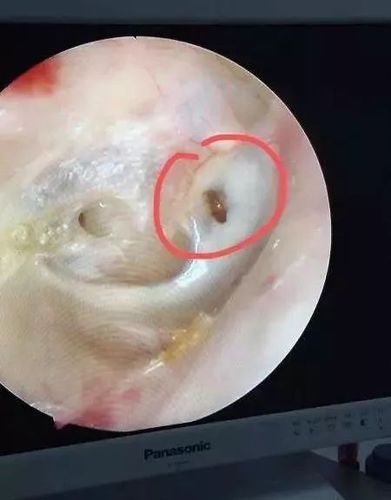 梦见耳朵里有虫子爬出