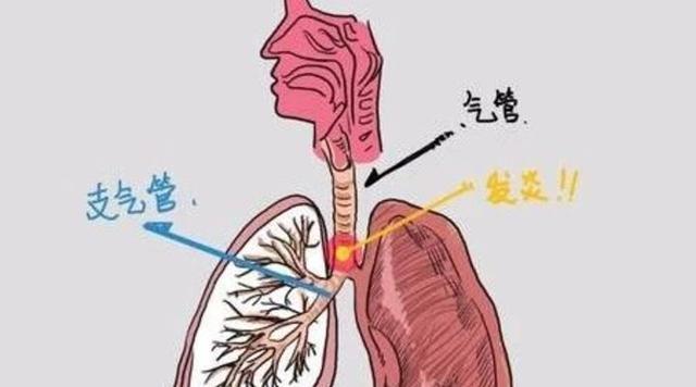 梦见支气管炎将会发生什么事情