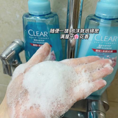 梦见头皮屑周公解梦,梦见头皮屑是什么意思?