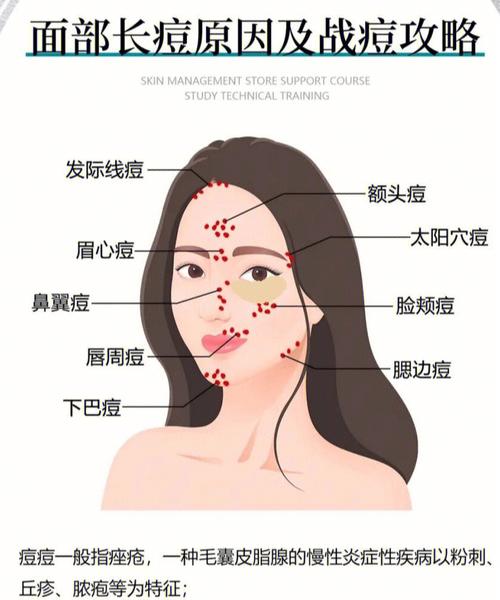 梦见脸上长痘