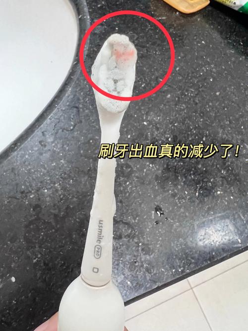 梦见刷牙出血