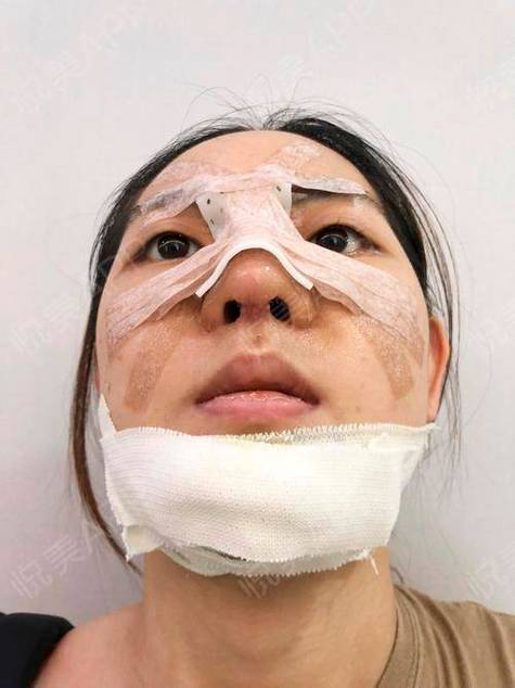 从鼻子看老公疼不疼你