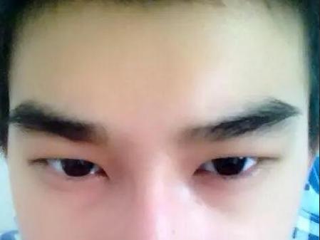 男人眼眉毛短稀的命运